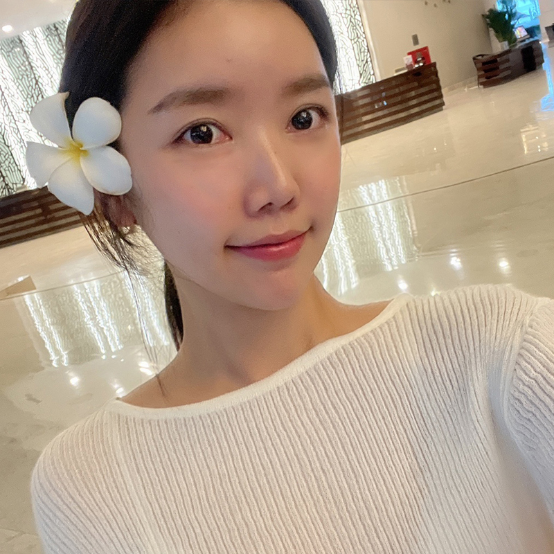 침샘보톡스효과 아직 모르시는분? 관련 이미지 1