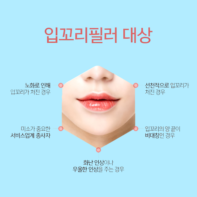 처진입꼬리 고민, 입꼬리필러로 자연스럽게 해결해요 관련 이미지 6