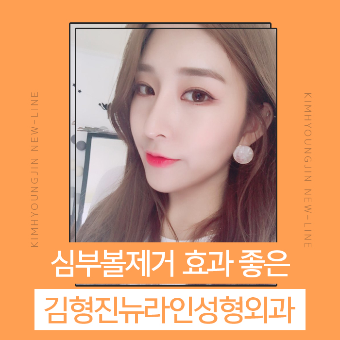 심부볼효과 확실하니까 관련 이미지 1