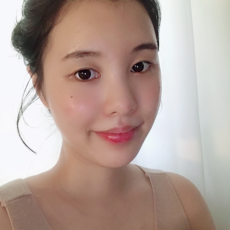 넥슬림주사시술은 김형진베이직에서 하셔야죠! 관련 이미지 2