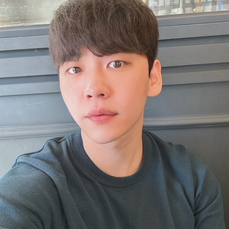 눈밑지방재배치전후 차이가 확실한 특별한 이유 관련 이미지 3