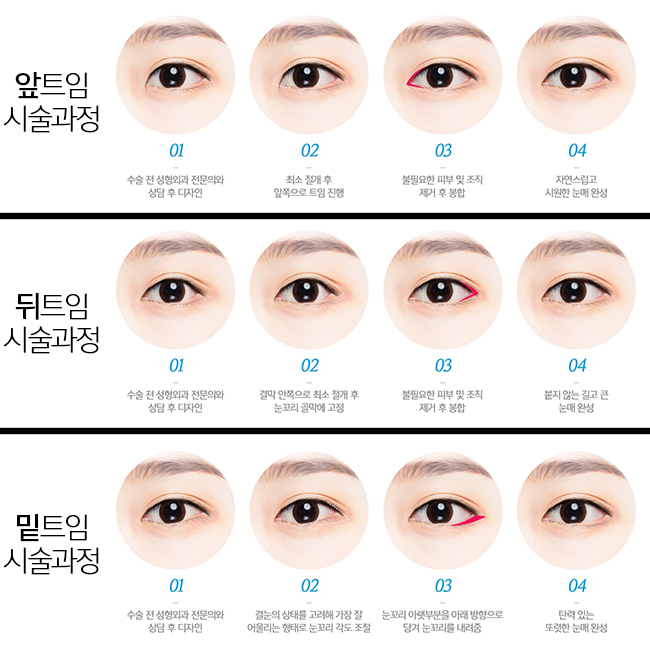 비절개밑트임으로 세련미 장착! 관련 이미지 2