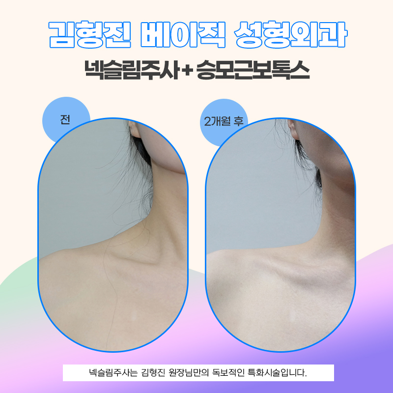 원조는 넥슬림주사전후 부터 다르네요 관련 이미지 5