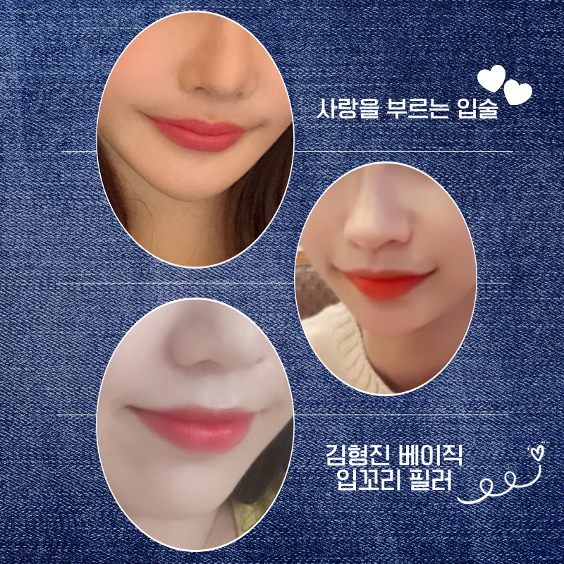 입꼬리필러잘하는곳은 다 이유가 있습니다 관련 이미지 4