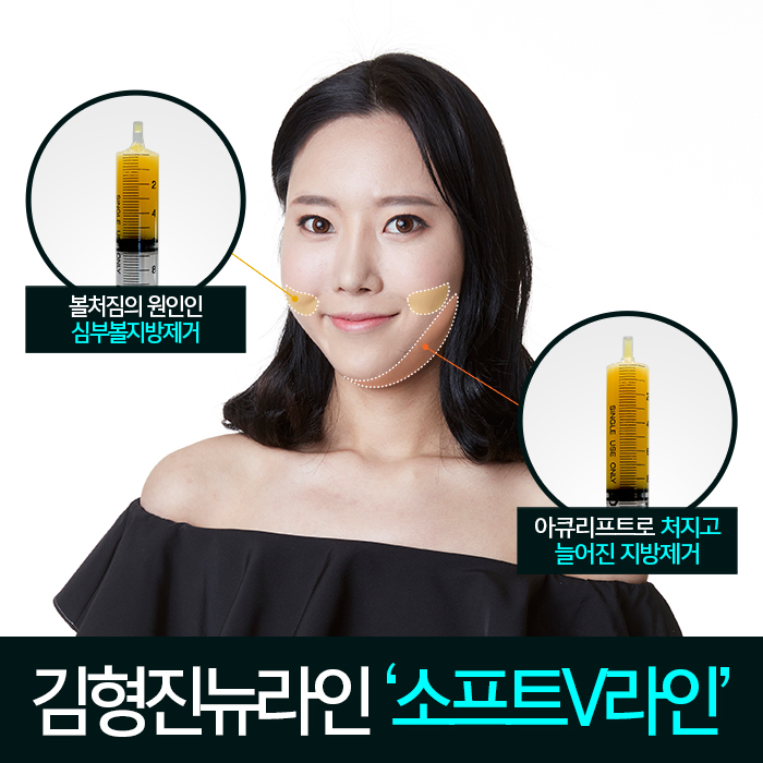 안면윤곽수술후볼처짐 진짜 해결책은 따로 있어! 관련 이미지 4