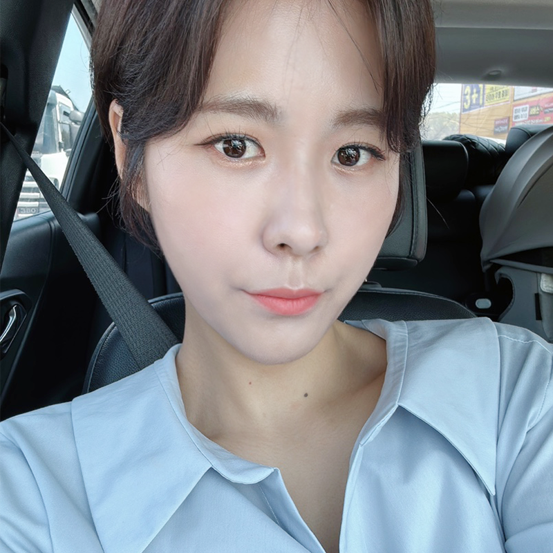 눈밑지방재배치회복기간 걱정하지 마세요 관련 이미지 1