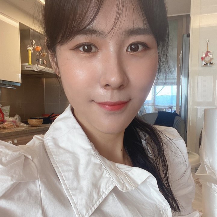 빠르게 눈밑지방없애는방법으로 선택한 눈밑지방재배치, 후회 없어요 관련 이미지 2