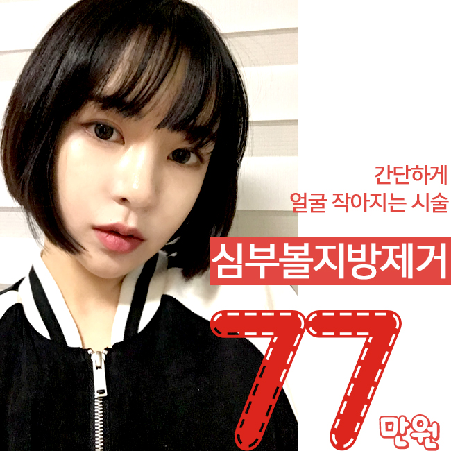 얼굴작아지는시술 이거지~ 관련 이미지 1