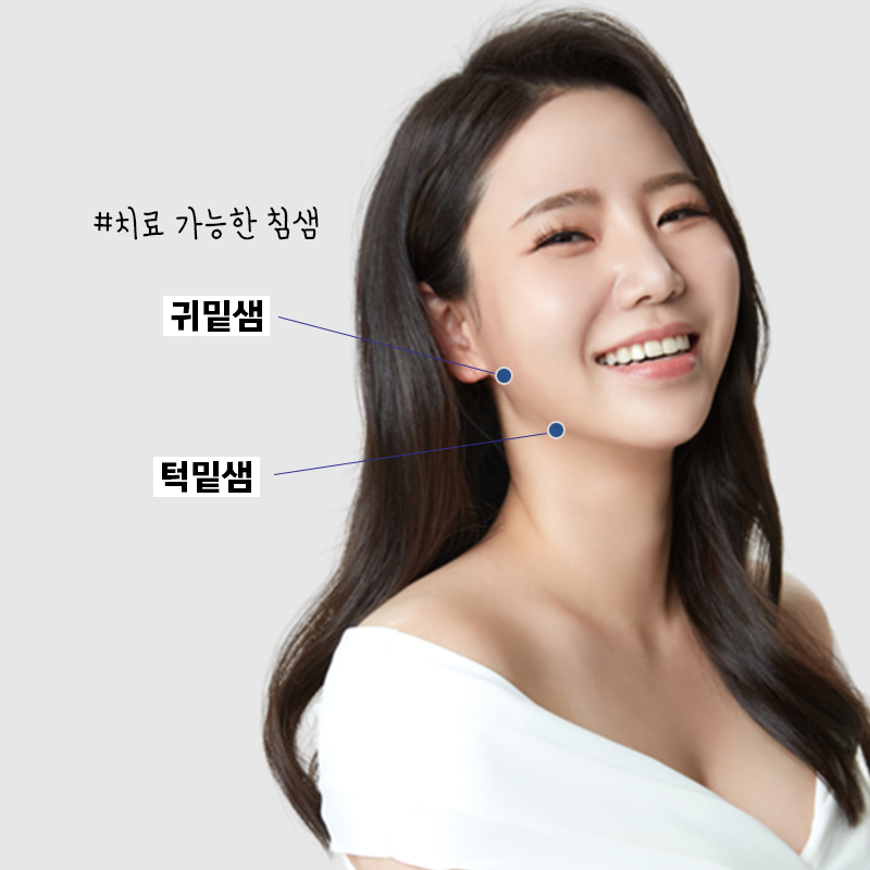 침샘비대증치료방법 간단해요! 관련 이미지 2