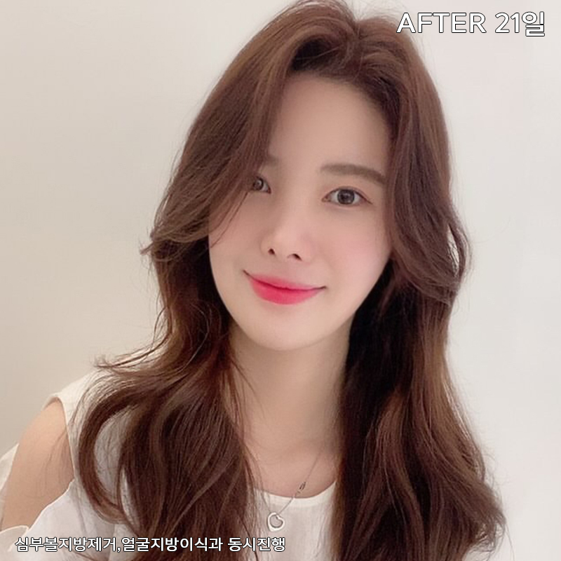 얼굴살제거 방법? 바로 알려드릴게요! 관련 이미지 5