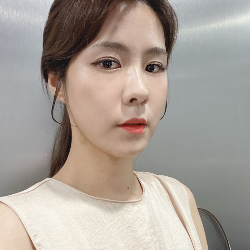 웨딩시술 김형진베이직에서 하셔야죠! 관련 이미지 4