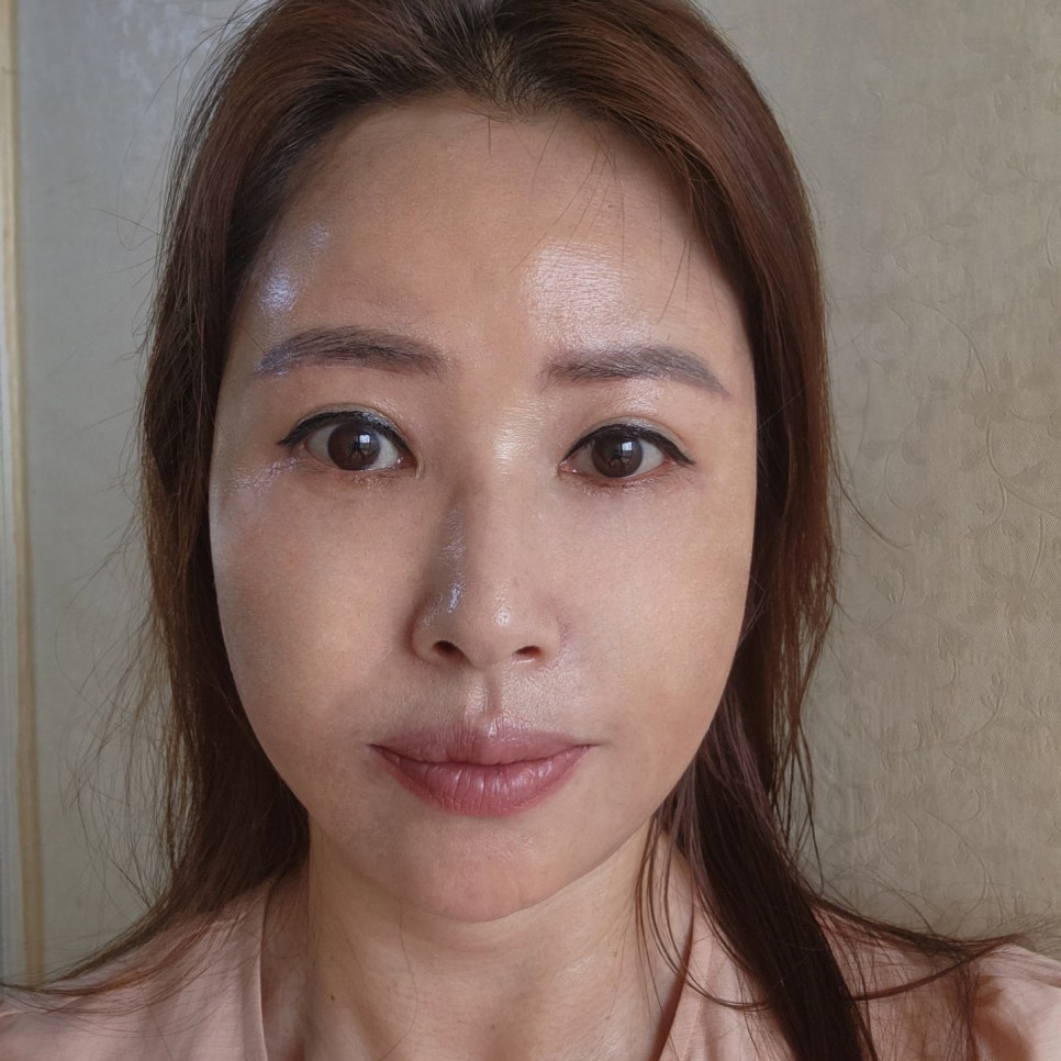 중년눈성형 고려 중이라면 김형진베이직에서! 관련 이미지 2