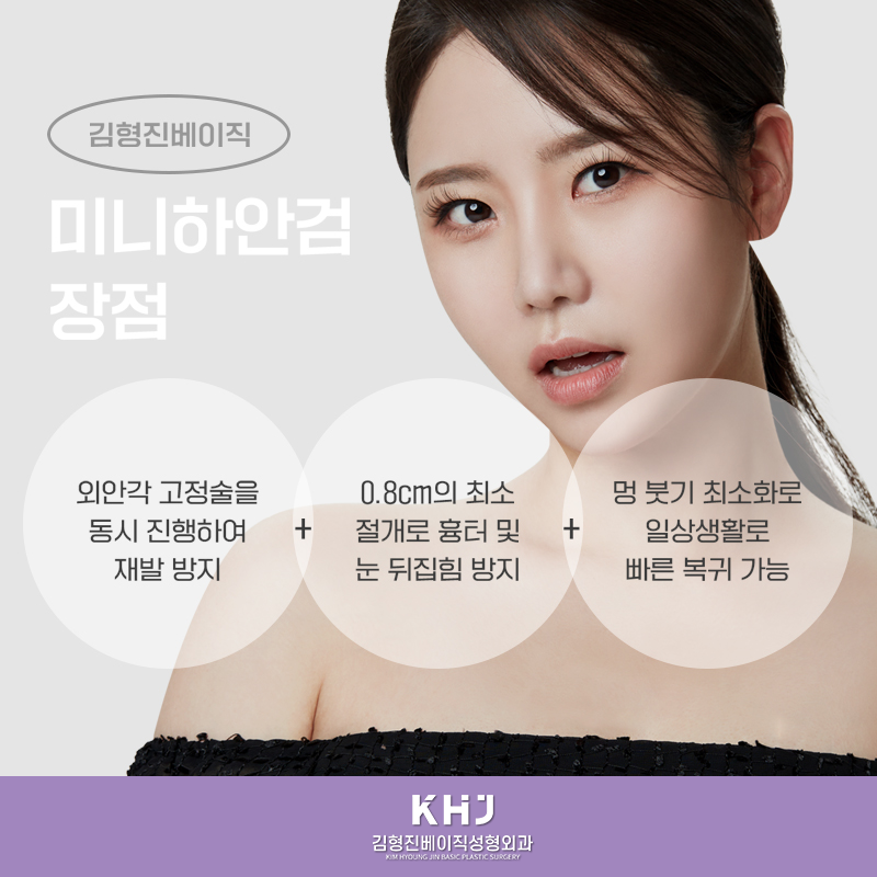 미니하안검흉터 걱정되시죠? 관련 이미지 5