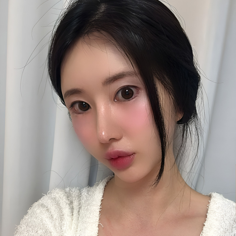 빠르게 눈밑지방없애는방법 찾고있다면 들어오세요! 관련 이미지 5