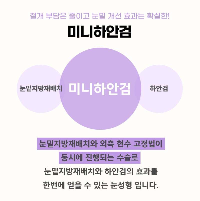 중년하안검 아무거나 하지 마세요 관련 이미지 3