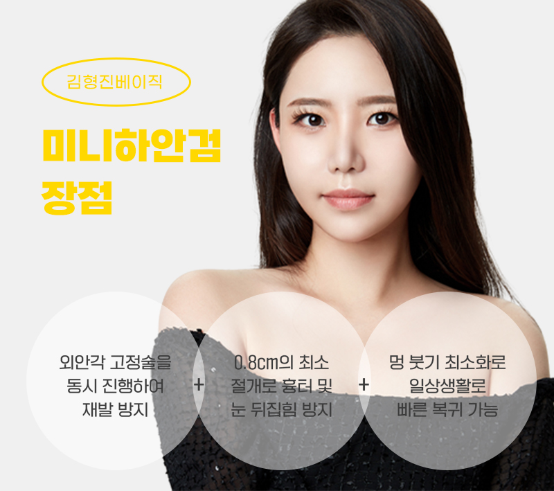 나이들어 보이는 눈, 중년눈수술 미니하안검으로 되돌려요 관련 이미지 4