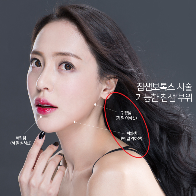 침샘보톡스 , 침샘비대증 해결! 이거 진짜 실화냐? 관련 이미지 2