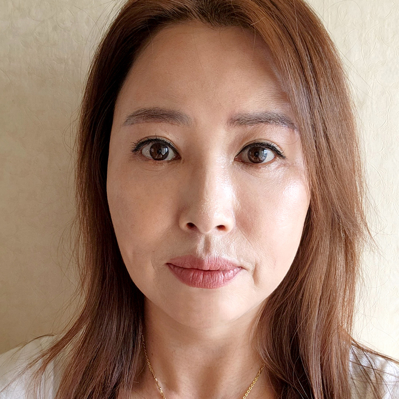 미니하안검흉터 걱정하지마세요! 관련 이미지 1