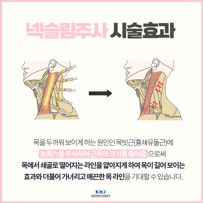 강남웨딩관리 넥슬림주사로 드레스핏 완성했어요 관련 이미지 4