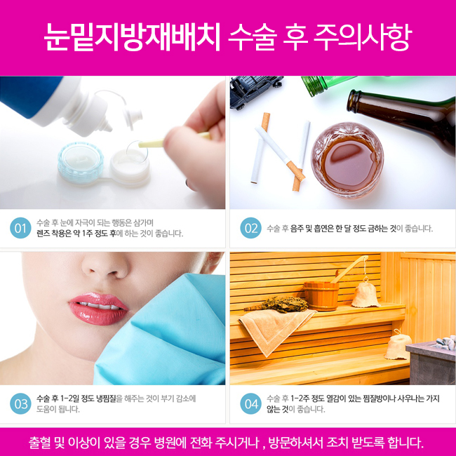 눈밑지방재배치수술비용으로 젊음을 사자! 관련 이미지 4