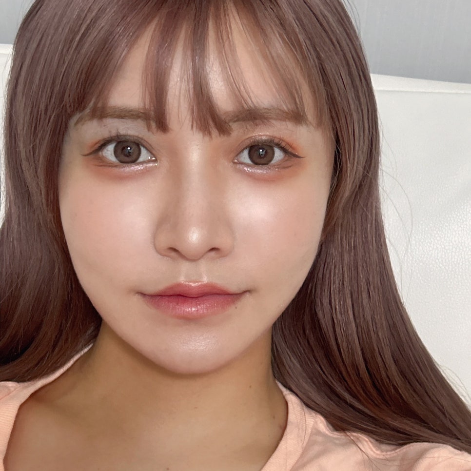 칙칙한 눈가 때문에 우울한 인상 걱정이라면? 가장 확실한 눈밑지방제거방법 관련 이미지 1