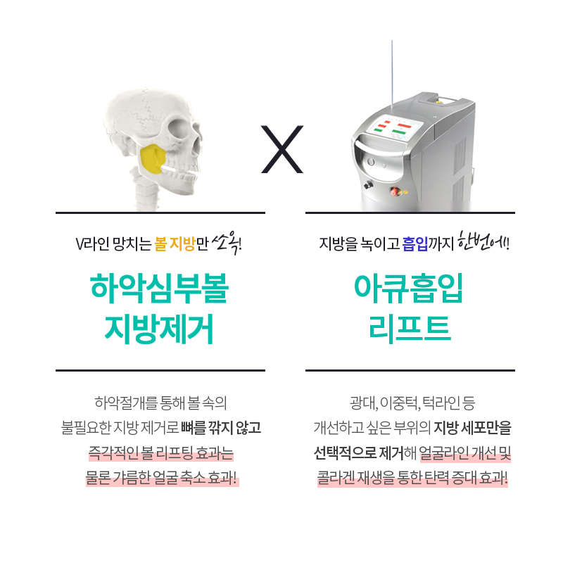 이제는 소프트하게! 얼굴지방흡입수술로 완성하는 부드러운 브이라인 관련 이미지 3