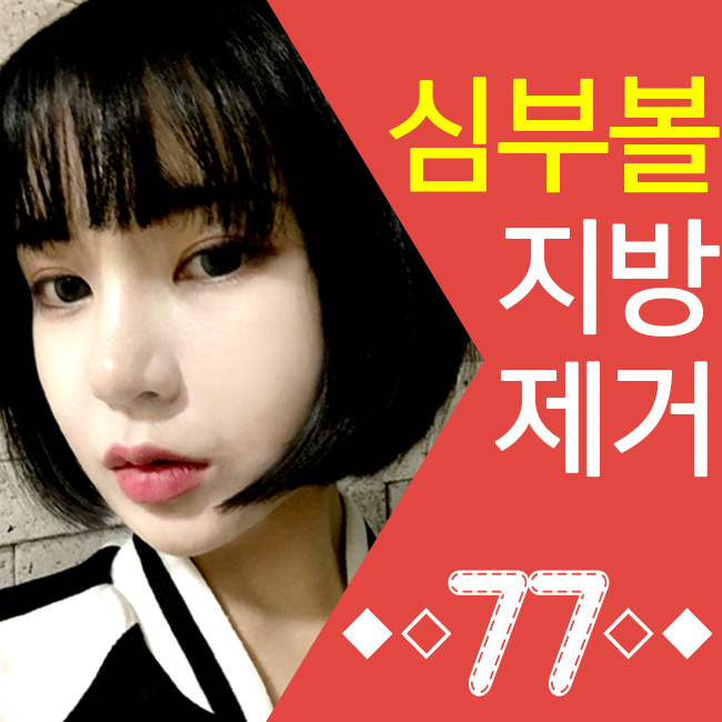 얼굴작아지는시술 이거지~ 관련 이미지 3