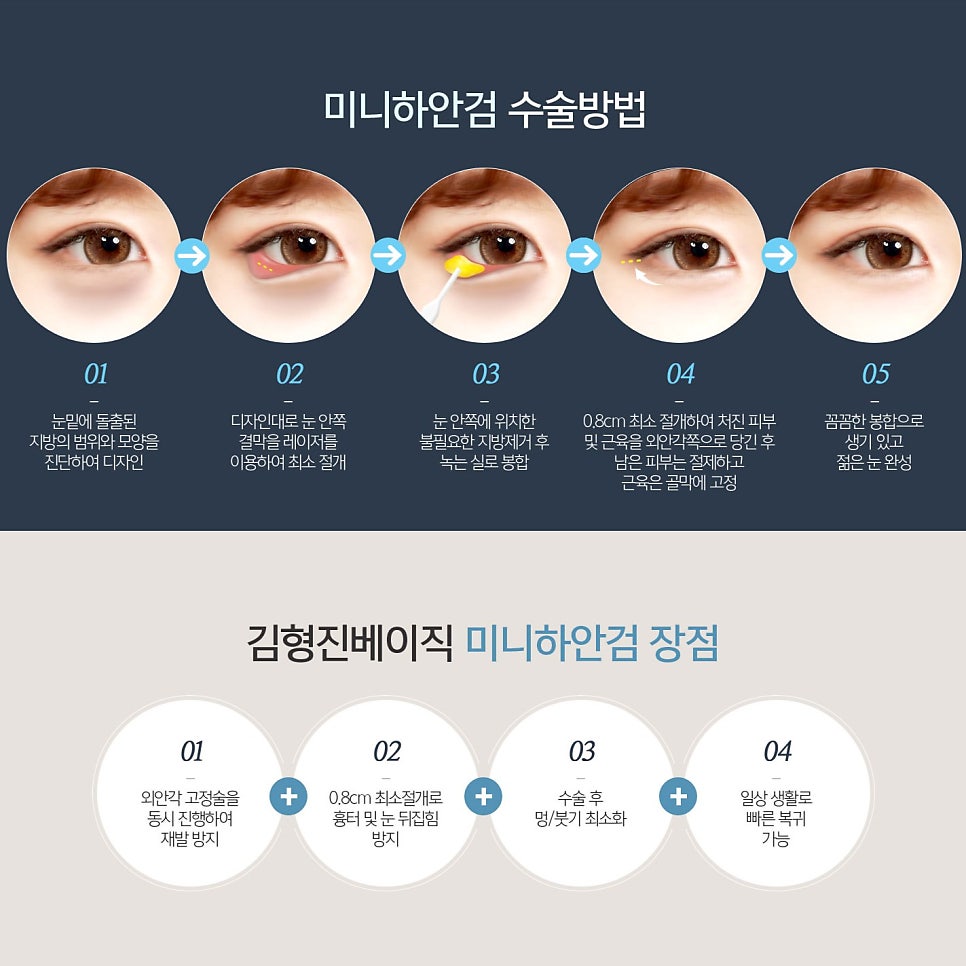 중년눈밑처짐 잃어버린 10년 찾아드렸어요! 관련 이미지 5