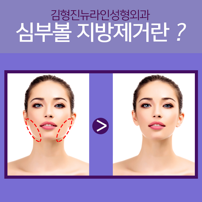 심부볼 정리? 간단하지~ 관련 이미지 2