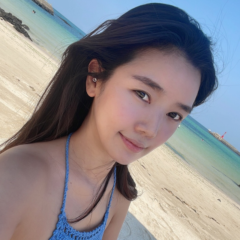 눈밑지방재배치흉터 보이지 않는 게 맞아요! 관련 이미지 5