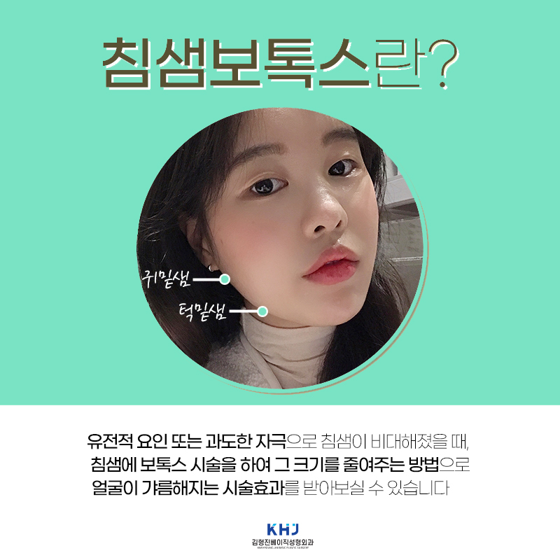 침샘치료하고 한결 가벼워진 턱 라인까지 만들었어요 관련 이미지 3