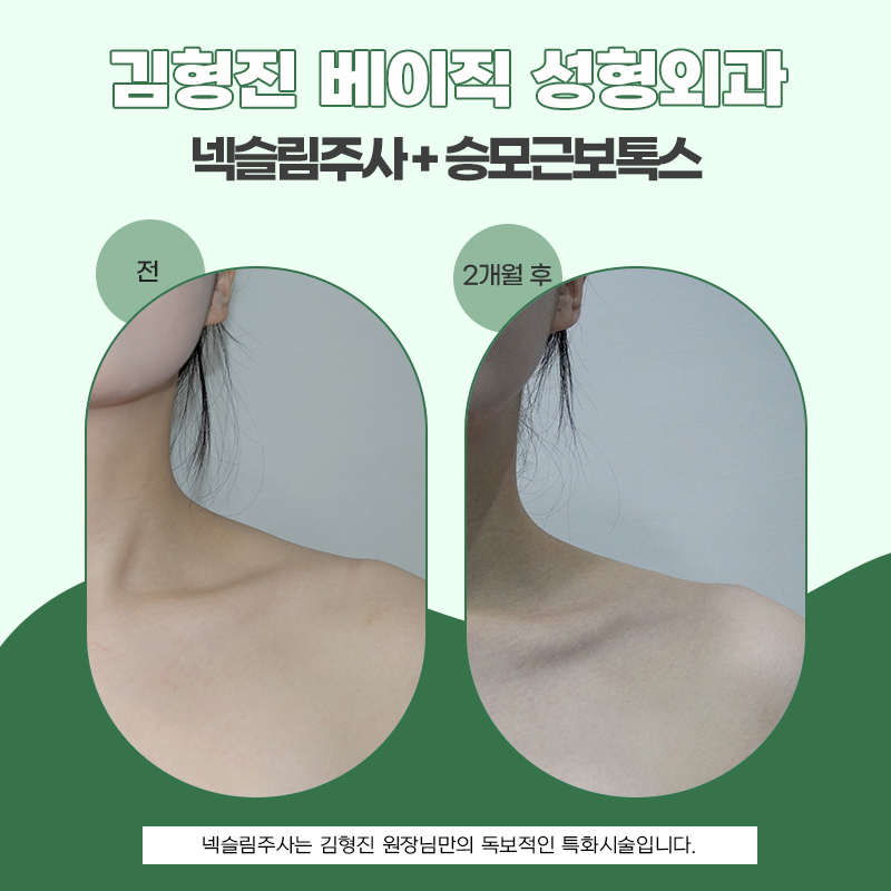 목얇아지는법 모르겠다면 들어오세요! 관련 이미지 6