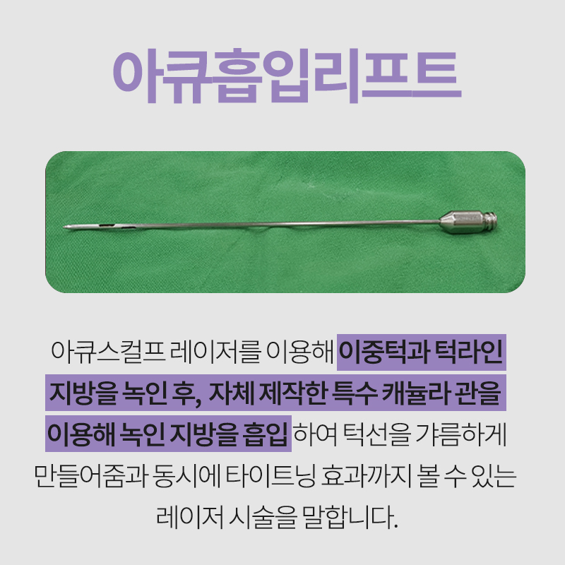 이중턱지방흡입흉터 안 보여요! 관련 이미지 2