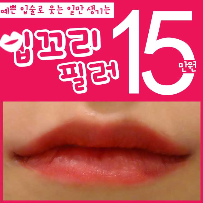 입꼬리필러후기 보고 낚이지 마세요! 관련 이미지 1