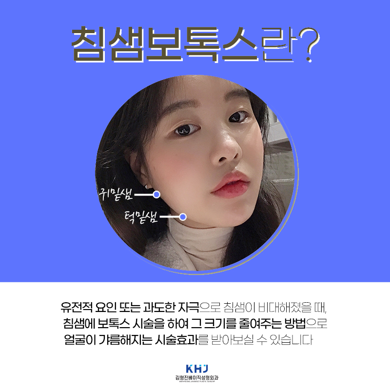 턱밑침샘보톡스로 얼굴선은 살리고, 턱 밑은 가볍게! 관련 이미지 4