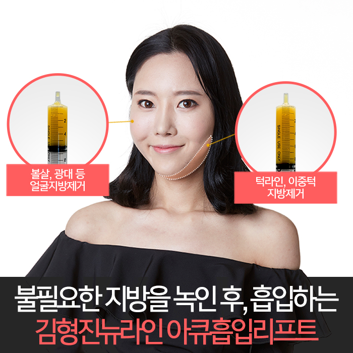 옆광대지방흡입 확실한건 아큐리프트다! 관련 이미지 4