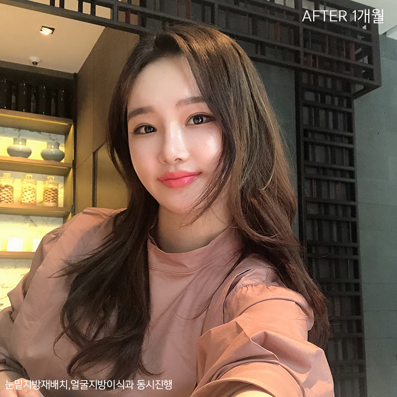 얼굴지흡방법 아직 모르신다구요? 관련 이미지 4