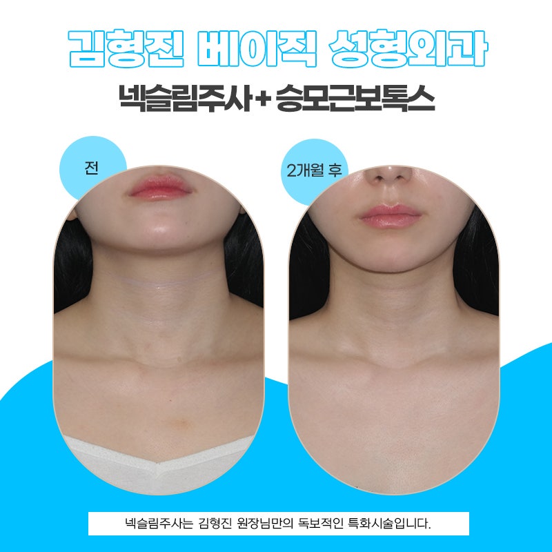 넥슬림주사시술 알아보는 중이라면 관련 이미지 5