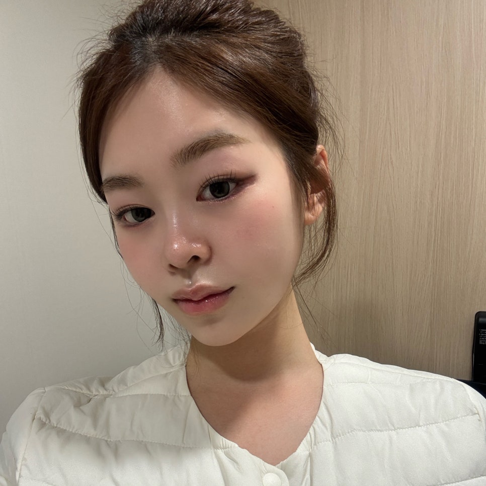 Apgujeong Salivary Gland Botox If Your Jawline Looks Blunt image 3