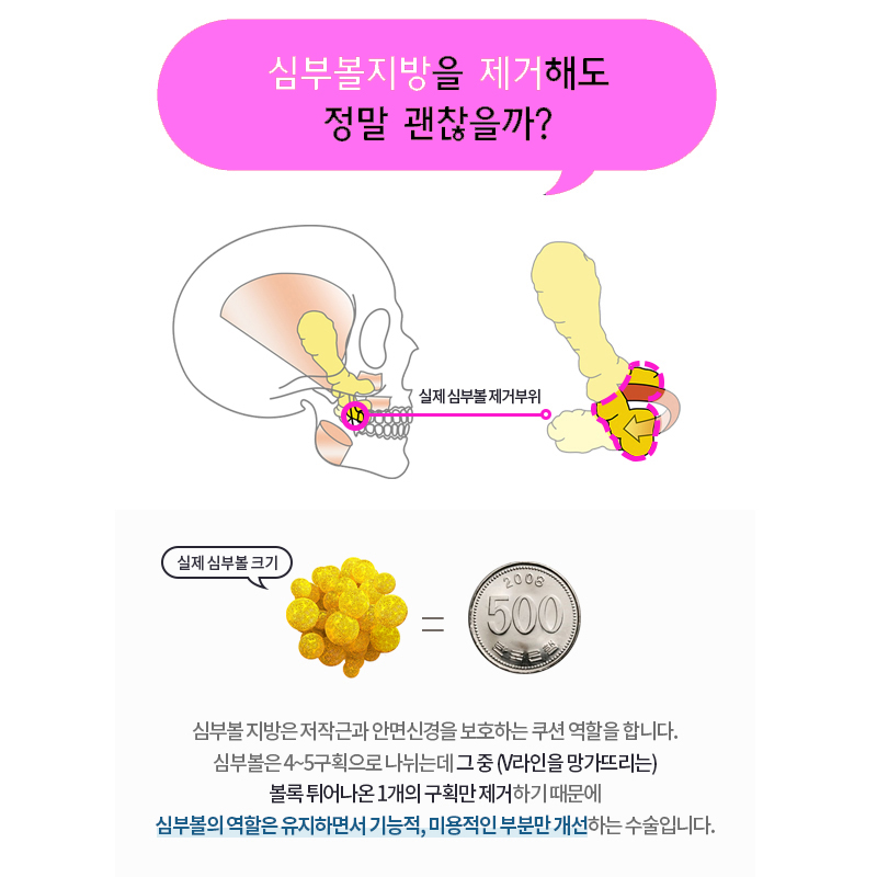 I Achieved Both Deep Cheek Fat Removal and a Lifting Effect! image 4