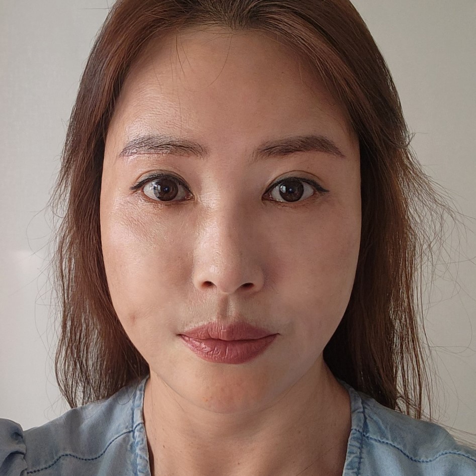 중년눈수술 걱정돼서 망설이고 있다면 관련 이미지 2