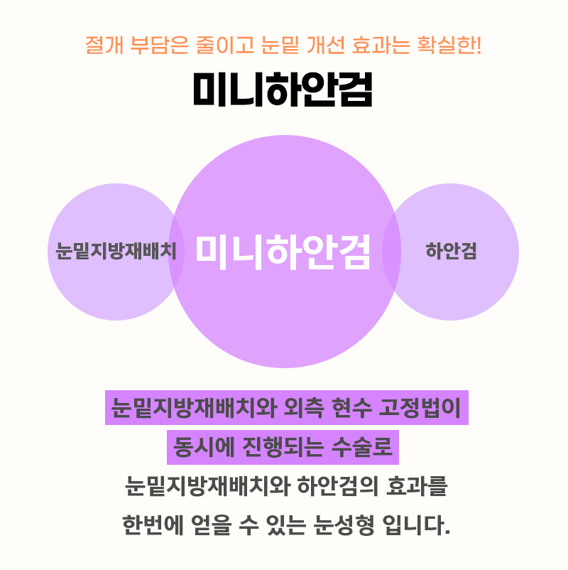 미니하안검잘하는곳에서 받아야 하는 이유 관련 이미지 3