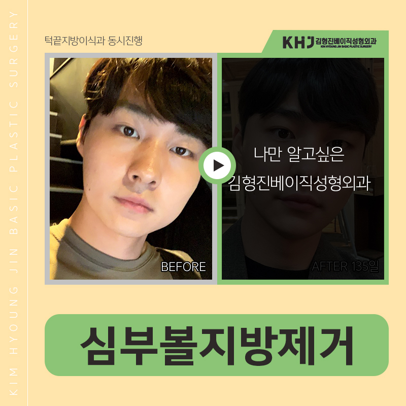심부볼위치 어딘지 궁금하셨다구요? 관련 이미지 3