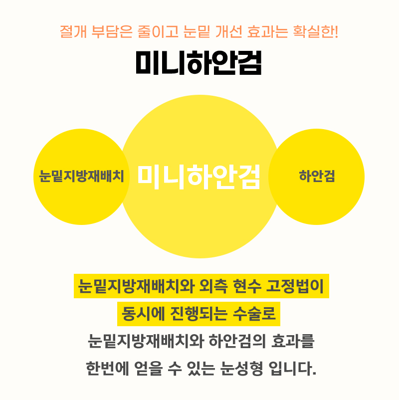 효도성형전후 보고 신중하게 결정했어요 관련 이미지 3