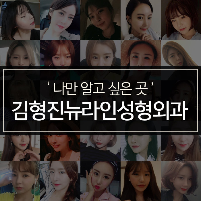 명절성형 지금부터 알아봐야죠 관련 이미지 4
