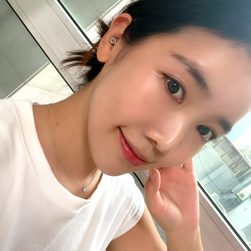 눈밑지방재배치부작용 때문에 고민 중인 분? 관련 이미지 1