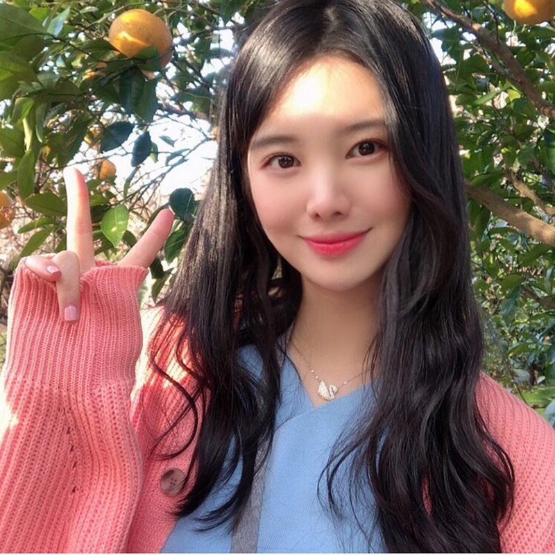눈밑재수술 필요없는 김형진베이직 관련 이미지 5