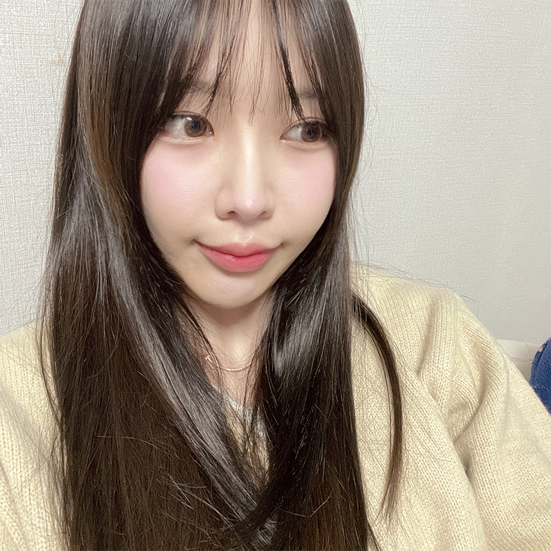 압구정입꼬리필러 어디가 잘하냐구요? 관련 이미지 5