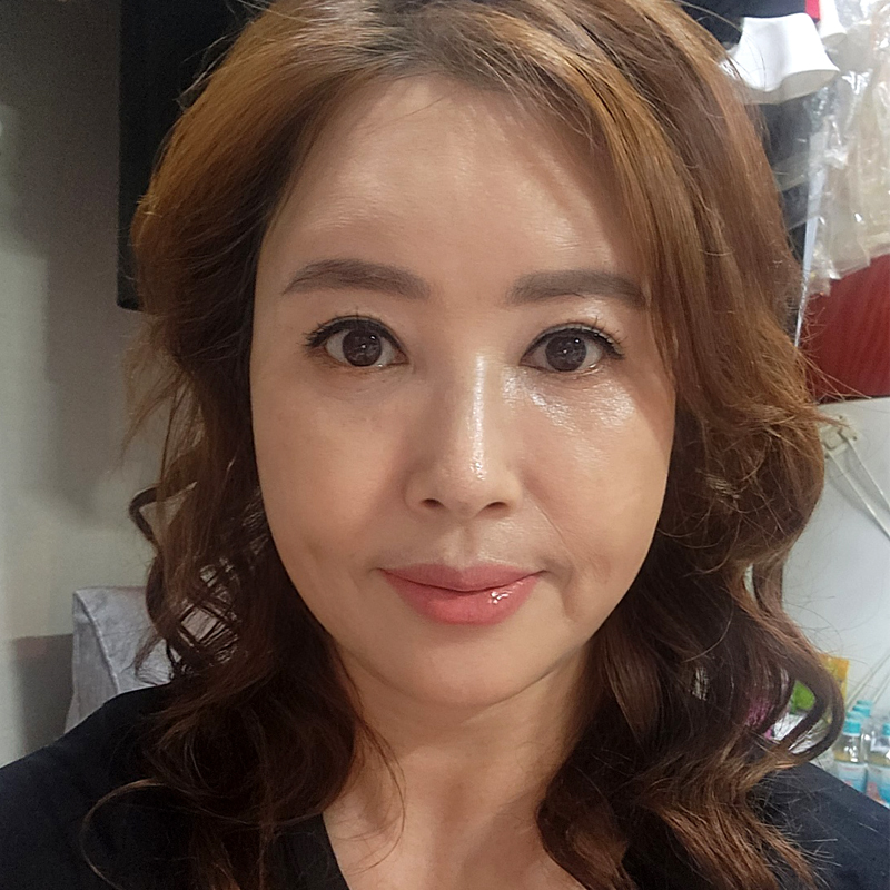 미니하안검절개 너무 깔끔해 관련 이미지 1