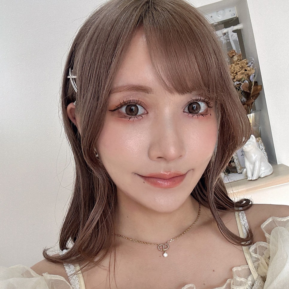 재발없는 눈밑지방재배치수술은 김형진베이직이 유일해요! 관련 이미지 1